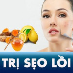 10 công thức trị sẹo lồi tại nhà NHANH NHẤT bằng thiên nhiên