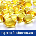 Đi tìm cách Trị Sẹo Lồi bằng Vitamin E hiệu quả nhanh nhất
