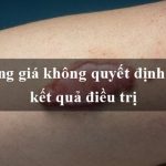 Điều trị Sẹo Lồi lâu năm giá bao nhiêu? Bảng giá Xóa Sẹo thẩm mỹ tại Kangnam