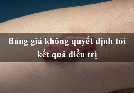 Điều trị Sẹo Lồi lâu năm giá bao nhiêu? Bảng giá Xóa Sẹo thẩm mỹ tại Kangnam
