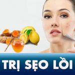 10 công thức trị sẹo lồi tại nhà NHANH NHẤT bằng thiên nhiên