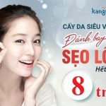 Trị Sẹo Lõm ở Kangnam GIÁ RẺ nhất là bao nhiêu? Bảng giá chữa sẹo 2019