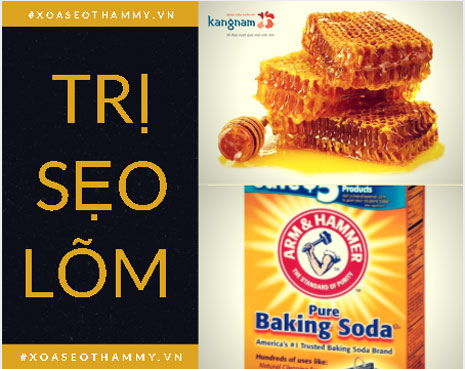 Trị sẹo lõm bằng mật ong – Giải pháp chữa trị sẹo lâu năm SIÊU HIỆU QUẢ