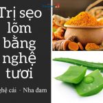3 cách trị sẹo bằng nghệ tươi mà bạn không ngờ tới