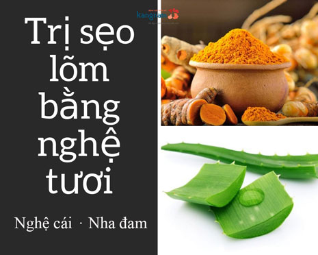 3 cách trị sẹo bằng nghệ tươi mà bạn không ngờ tới