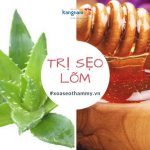 Hướng dẫn cách trị sẹo lõm bằng nha đam hiệu quả BẤT NGỜ