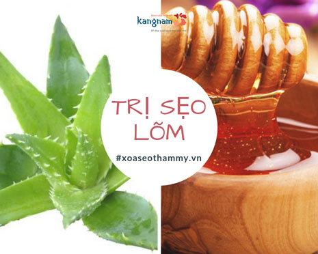 Hướng dẫn cách trị sẹo lõm bằng nha đam hiệu quả BẤT NGỜ