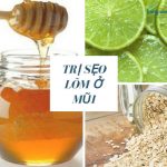 Hướng dẫn các phương pháp chữa trị sẹo lõm ở mũi cho các loại da khác nhau