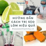 Review những phương pháp trị sẹo lõm thủy đậu hiệu quả nhất