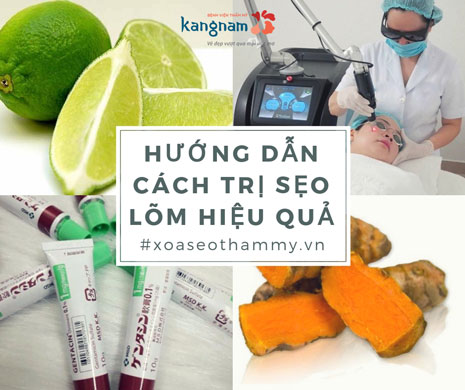 Review những phương pháp trị sẹo lõm thủy đậu hiệu quả nhất