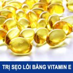 Đi tìm cách Trị Sẹo Lồi bằng Vitamin E hiệu quả nhanh nhất