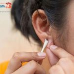 Những cách chữa sẹo lồi ở tai hiệu quả được chuyên gia da liễu khuyên dùng!