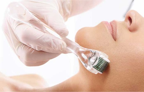 Thực hư về phương pháp lăn kim trị sẹo rỗ đang làm mưa làm gió trên thị trường làm đẹp