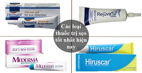 cơ địa sẹo lồi có cắt mí được không
