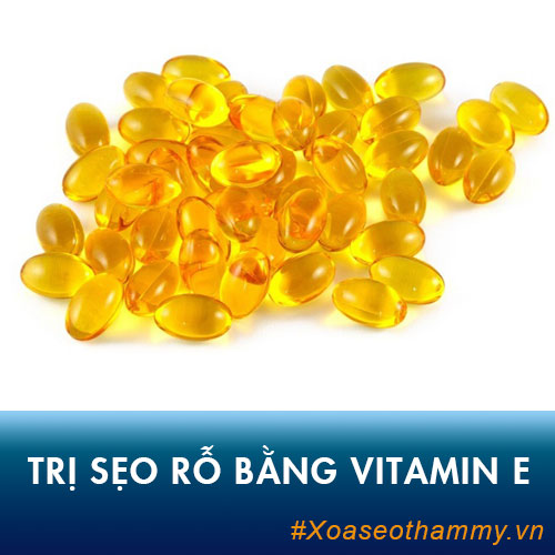 Chỉ 10 phút trị sẹo rỗ bằng vitamin E – Xóa sạch sẹo lâu năm