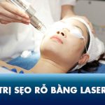 Điều trị sẹo rỗ bằng Laser Co2 Fractional có tốt không? Giá bao nhiêu tiền?