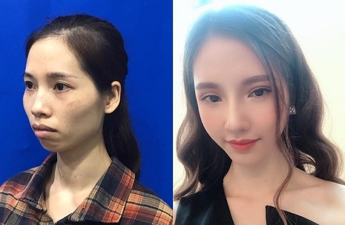 Phan thị May trước và sau khi thay đổi ngoại hình